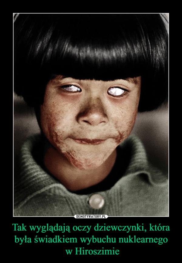 Tak wyglądają oczy dziewczynki, która była świadkiem wybuchu nuklearnego w Hiroszimie –  