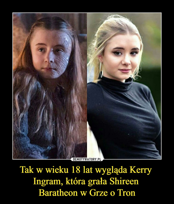Tak w wieku 18 lat wygląda Kerry 
Ingram, która grała Shireen 
Baratheon w Grze o Tron