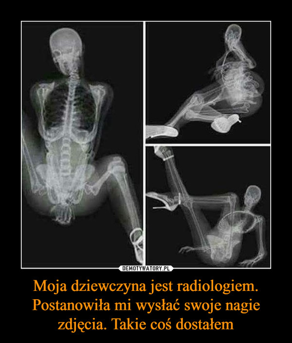 Moja dziewczyna jest radiologiem. Postanowiła mi wysłać swoje nagie zdjęcia. Takie coś dostałem –  