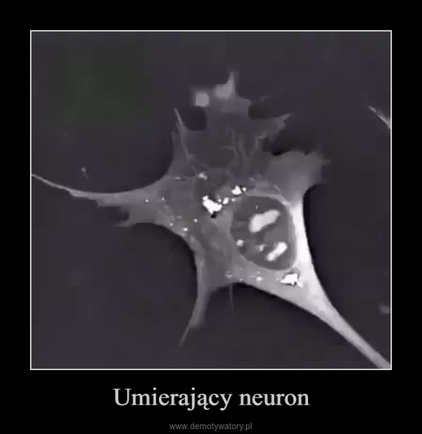 Umierający neuron –  