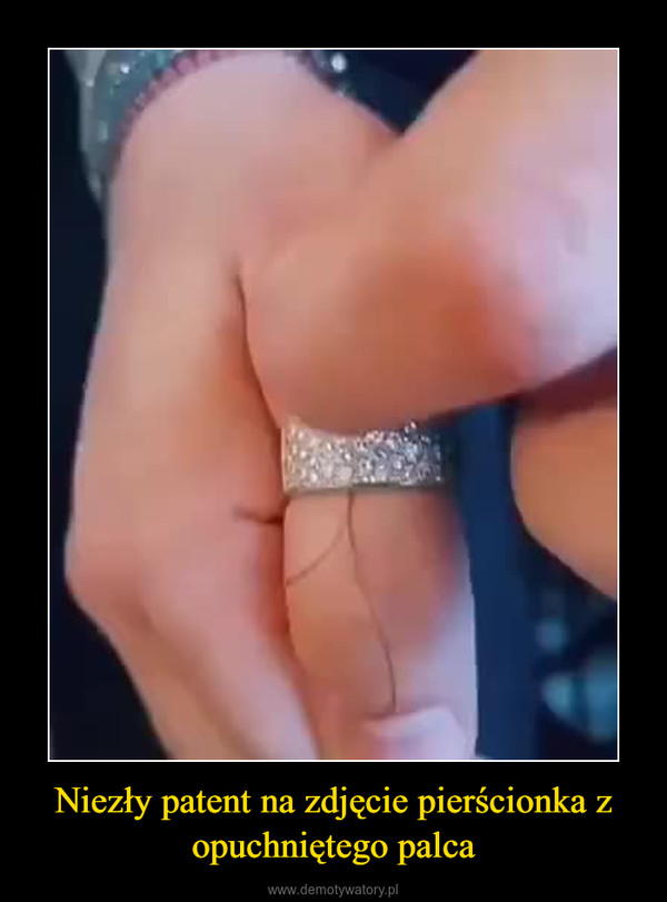 Niezły patent na zdjęcie pierścionka z opuchniętego palca –  