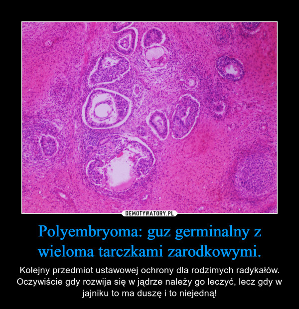 Polyembryoma: guz germinalny z wieloma tarczkami zarodkowymi.