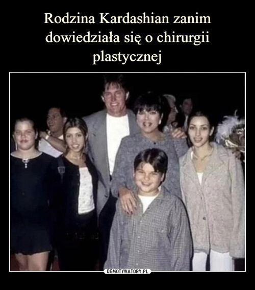 Rodzina Kardashian zanim dowiedziała się o chirurgii
plastycznej