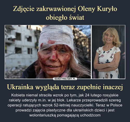 Zdjęcie zakrwawionej Oleny Kuryło obiegło świat Ukrainka wygląda teraz zupełnie inaczej