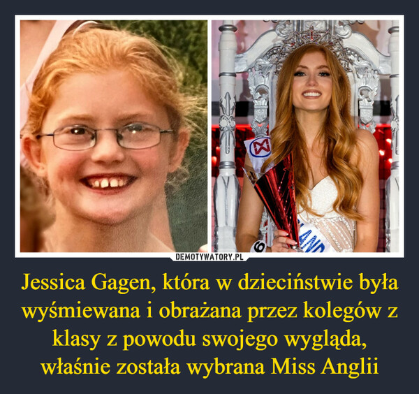 Jessica Gagen, która w dzieciństwie była wyśmiewana i obrażana przez kolegów z klasy z powodu swojego wygląda, właśnie została wybrana Miss Anglii